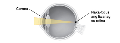 Cross section ng mata na ipinakikita ang liwanag na nagfo-focus sa retina.